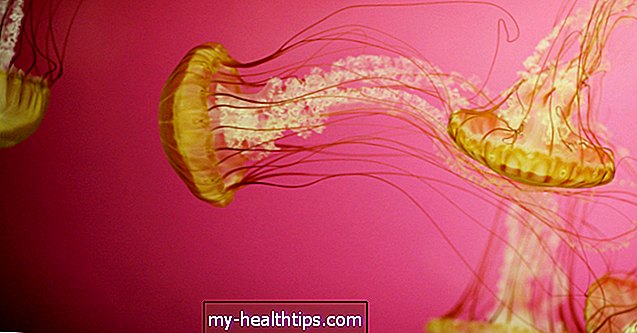 Можете ли да ядете медузи?